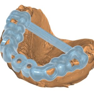 фото 3д моделирование стоматология 1