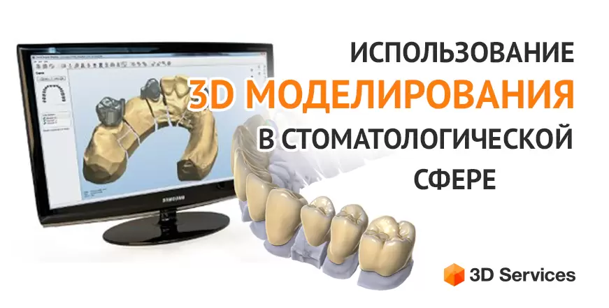 Баннер 3д моделирование стоматология