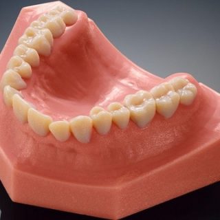 Фото 3D печати стоматологического шаблона