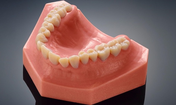 Фото 3D печати стоматологического шаблона