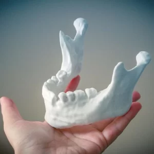 Фото печать на 3д принтер для медицины 3d services 3