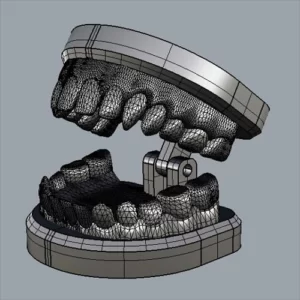 Фото 3D моделирования диагностического шаблона