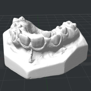 Фото 3D моделирования слепка