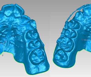 Фото Сканирование в стоматологии 3d services 5