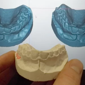 фото Сканирование в стоматологии 3d services 6