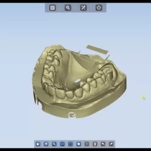 Фото Сканирование в стоматологии 3d services 3