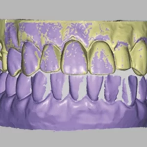 Фото Сканирование в стоматологии 3d services 2