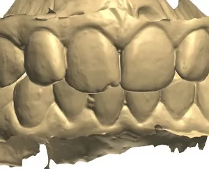 Фото Сканирование в стоматологии 3d services 1