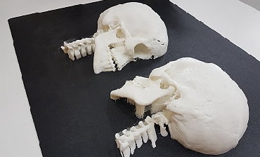 Фото Физические и CAD-модели на основе КТ и МРТ 3д services