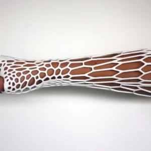 3Д печать лангетки на руку 3d services 4