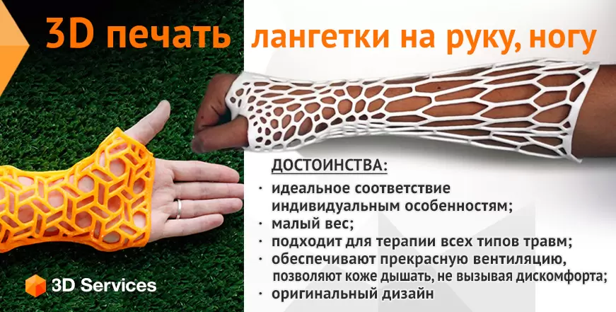 3Д печать лангетки на руку 3d services