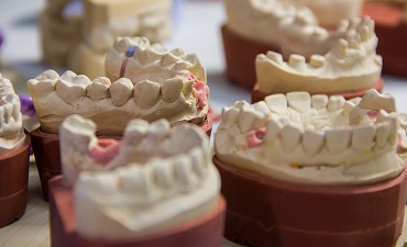 Фото 3D сканирование гипсовых стоматологических слепков 3DServices