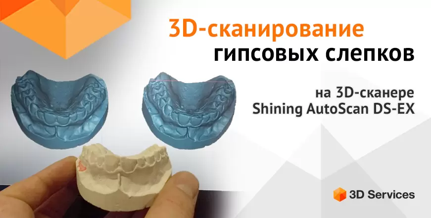 Баннер 3D сканирование гипсовых стоматологических слепков 3d services 1
