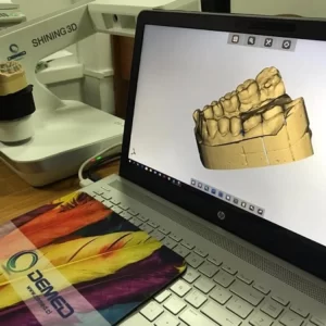Фото 3D сканирование гипсовых стоматологических слепков 5
