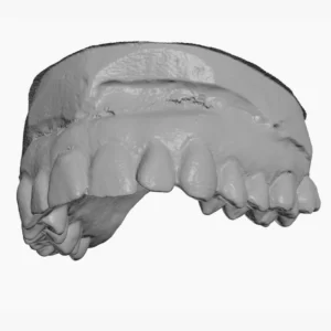Фото 3D сканирование гипсовых стоматологических слепков 8