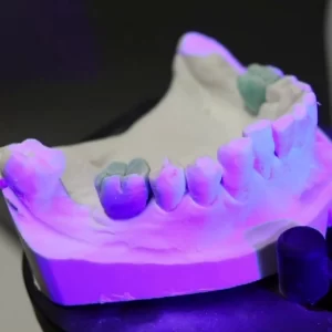 Фото 3D сканирование гипсовых стоматологических слепков 9
