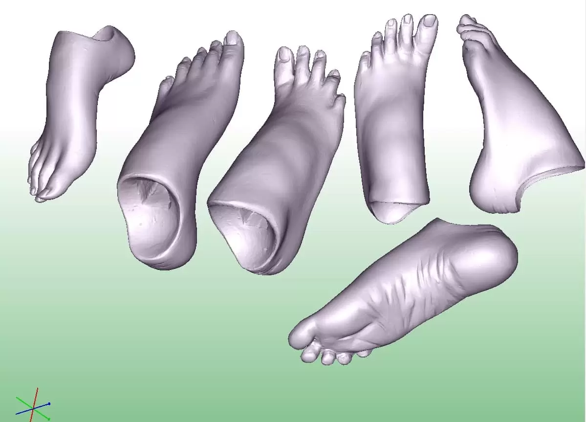 Фото 3D печать рук и ног 1