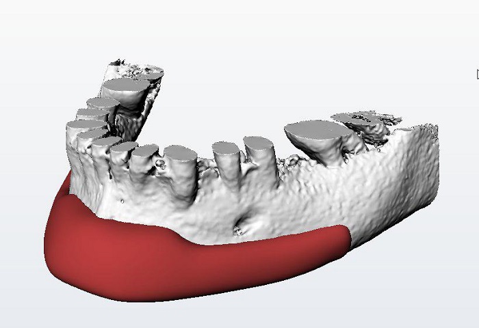Фото Создание 3Д моделей имплантатов 10