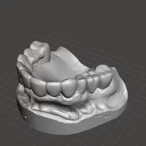 Фото 3D сканирование гипсового слепка 2