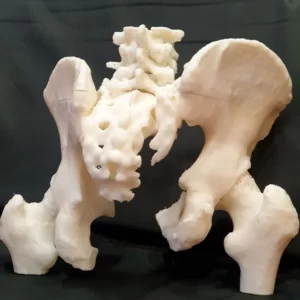 Фото 3D печать костей таза 2